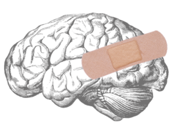 illustration of a brain with a band-aid over the area where obsessive thoughts occur